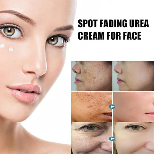 Spot Fading Urea Cream β Dark Spot & Freckle Remover
