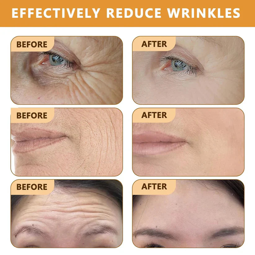 Botox Bee Venom Cream For Wrinkles and fine lines