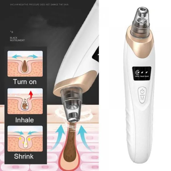 Electric Blackhead Suction Remover | Vacuum Extractor for Clear Skin