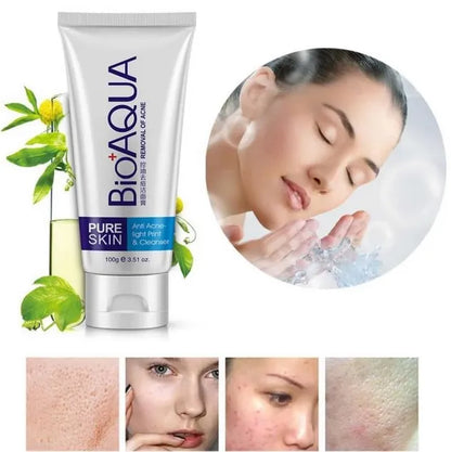 Bio Aqua Acne & Scar Removal Cream – Pimple & Dark Spot Treatment