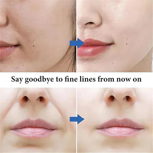 Spot Fading Urea Cream – Dark Spot & Freckle Remover