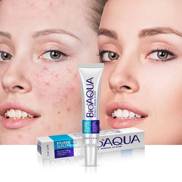 Bio Aqua Acne & Scar Removal Cream – Pimple & Dark Spot Treatment