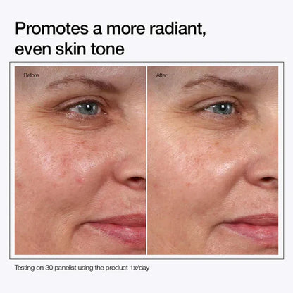 Glycolic Acid 7% 😍 Glow Toning Solution | Today Sale🔥45% OFF