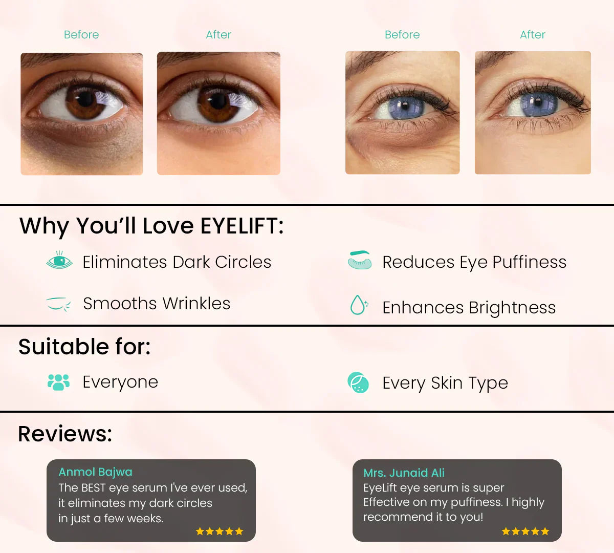 Eye Roller | Dark Circle Remover & Under Eye Care