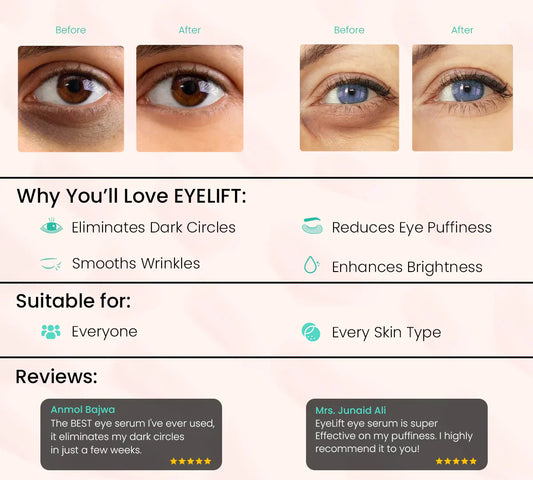 Eye Roller | Dark Circle Remover & Under Eye Care