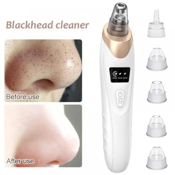 Electric Blackhead Suction Remover | Vacuum Extractor for Clear Skin