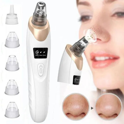 Electric Blackhead Suction Remover | Vacuum Extractor for Clear Skin