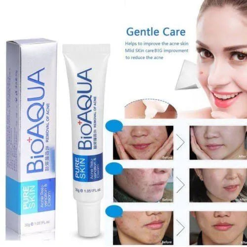 Bio Aqua Acne & Scar Removal Cream – Pimple & Dark Spot Treatment