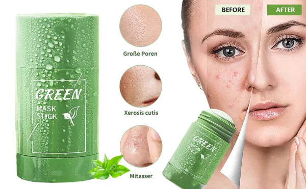 Green Tea Blackhead Remover Stick – Deep Clean & Oil Control Mask