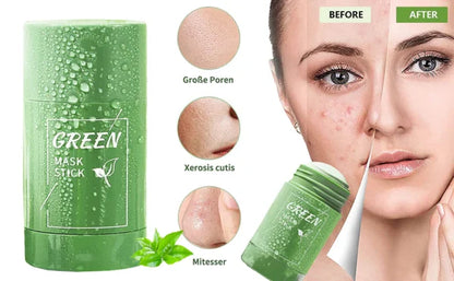 Green Tea Blackhead Remover Stick – Deep Clean & Oil Control Mask